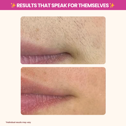 Reveal Silky-Smooth, Hair-Free Skin - Naturally!