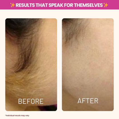 Reveal Silky-Smooth, Hair-Free Skin - Naturally!