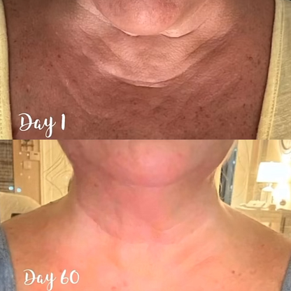 Transform Your Skin, Hair & Joints Naturally!