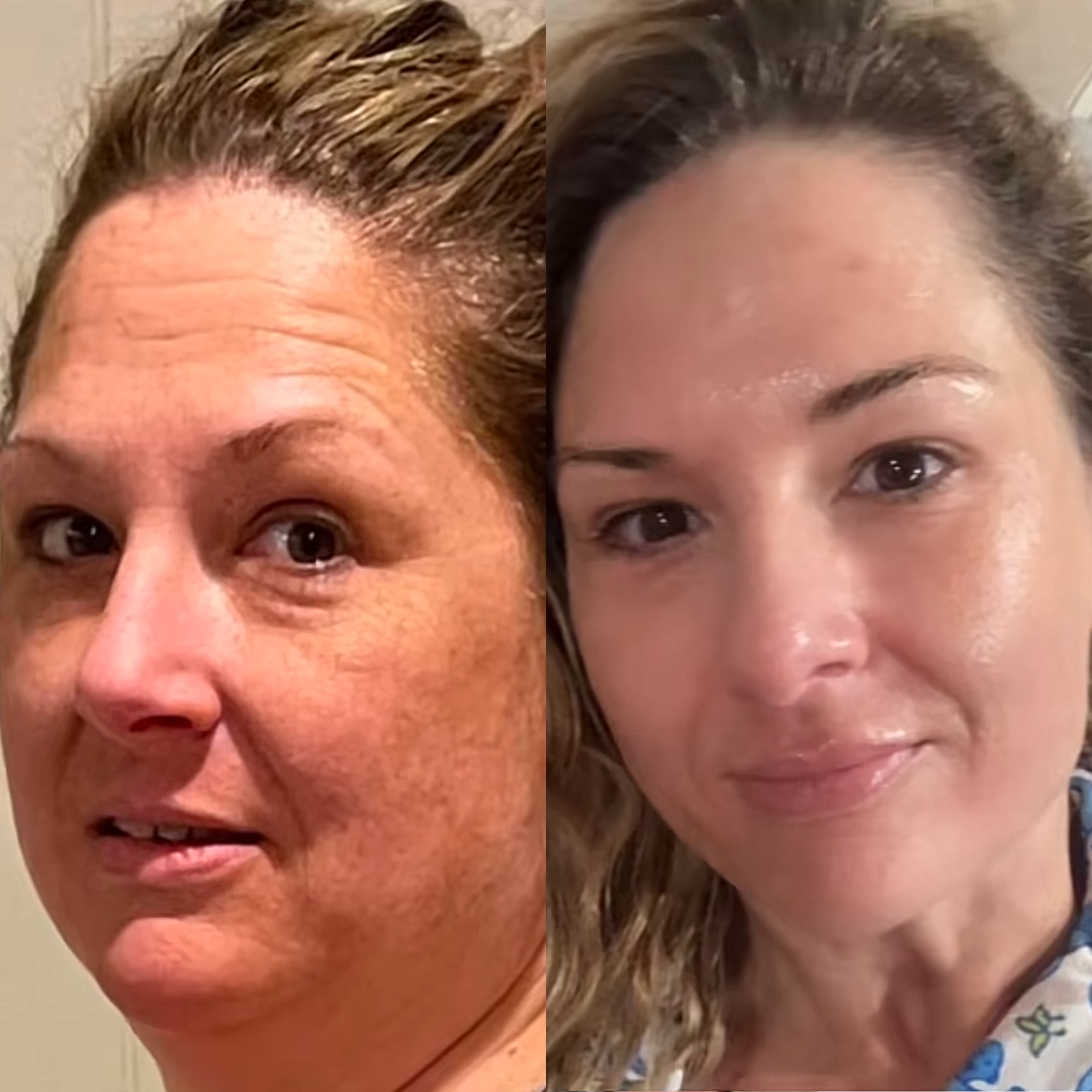 Transform Your Skin, Hair & Joints Naturally!