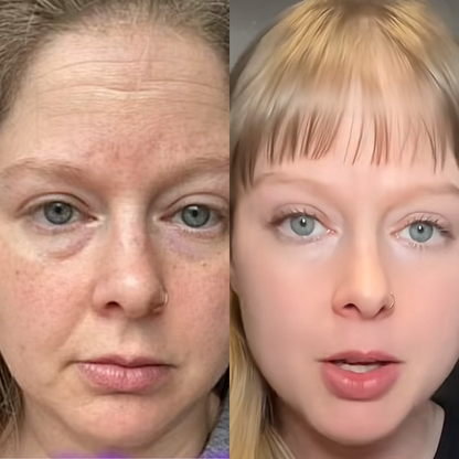 Transform Your Skin, Hair & Joints Naturally!