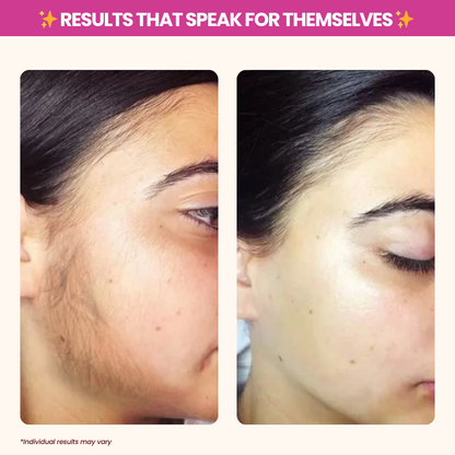 Reveal Silky-Smooth, Hair-Free Skin - Naturally!