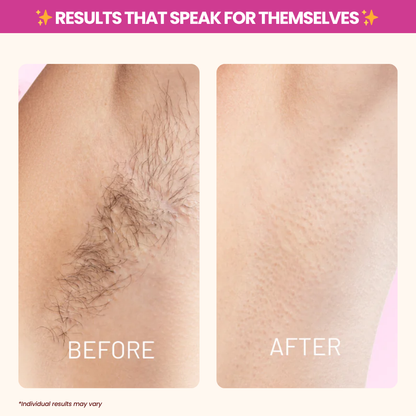 Reveal Silky-Smooth, Hair-Free Skin - Naturally!